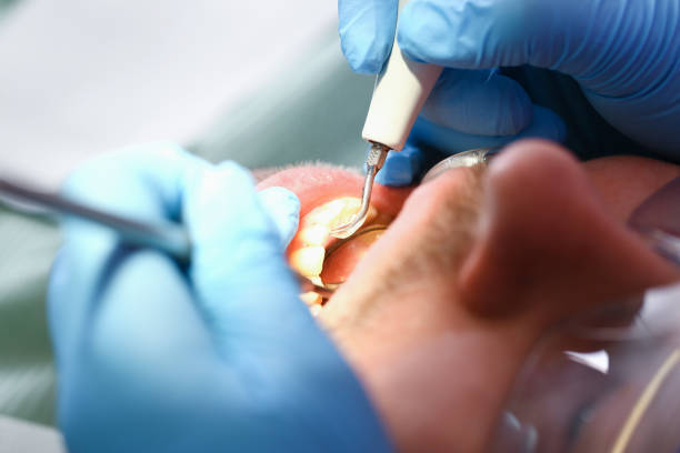 Best Dental Abscess Treatment in Carter, TX