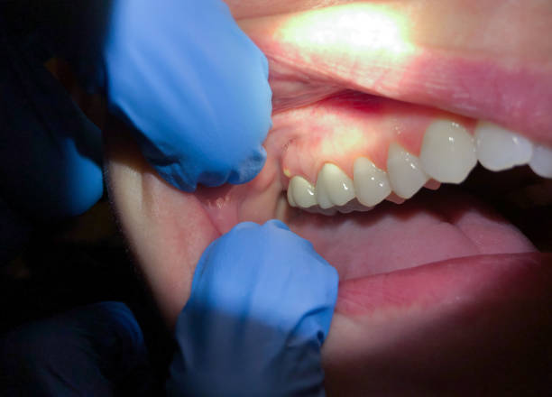 Best 24-Hour Emergency Dental Care in Carter, TX