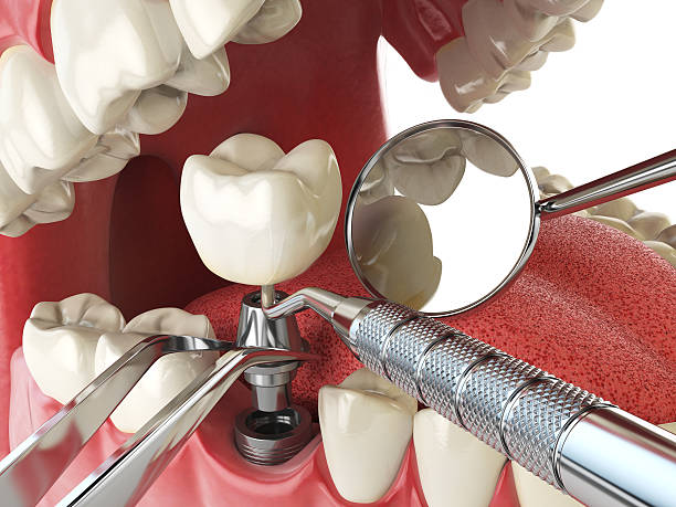 Best Emergency Treatment for Oral Infections in Carter, TX